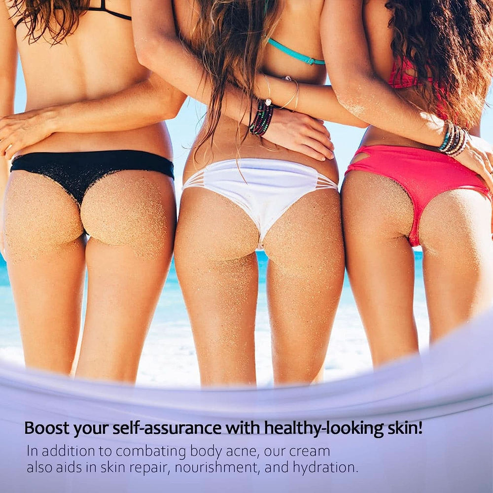 Anti-acne cream, 100 ml Cosmetics and Beauty Naty Shop