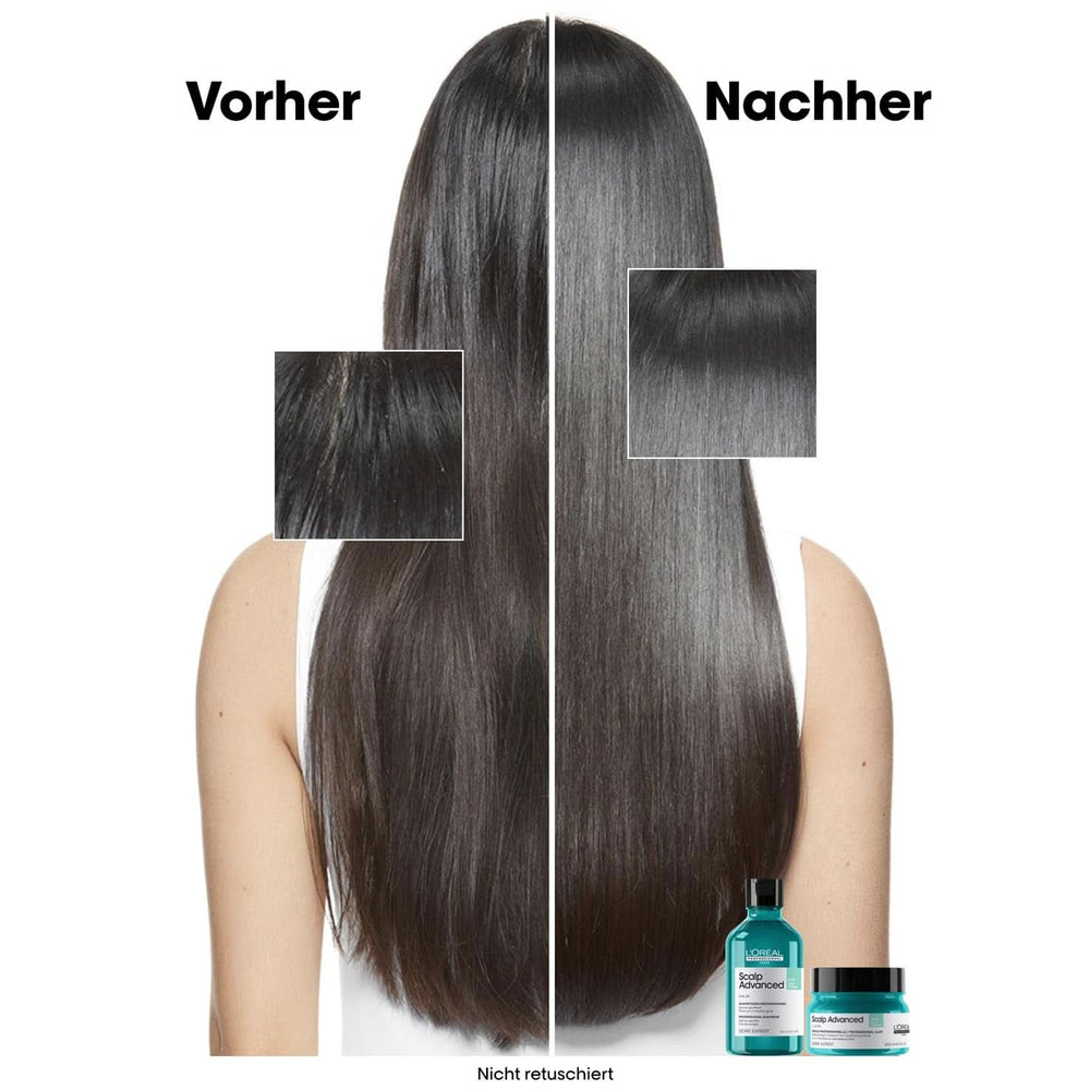 L'Oréal Professionnel Oily Scalp Cleansing Shampoo, 300ml Naty Shop Shower and Bath