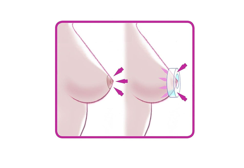 ELANEE Brust-Ringe, Schutz Der Brustwarze Bh-Kontakt Durch Hohllagerung, Ideal Bei Wunden, Entzündeten Brustwarzen Durch Stillen, 10 Stück (222-00) Accessories Food and Breastfeeding Bebe Naty Shop