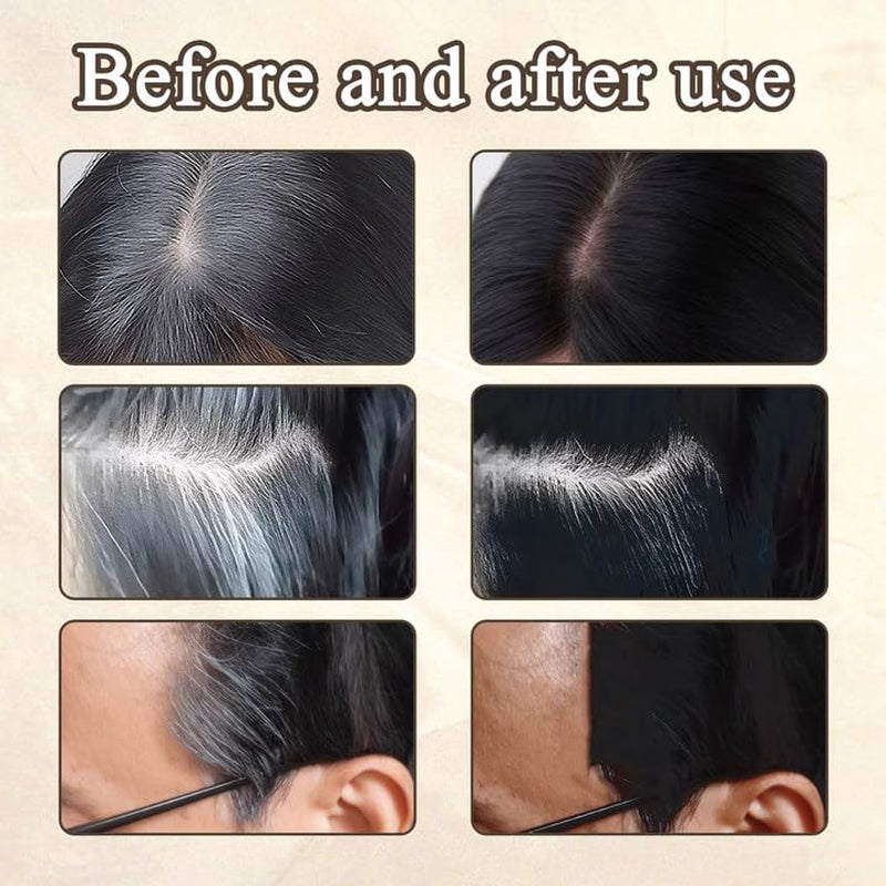 2 bucăți de pudră pentru linia părului maro închis, pudră pentru linia părului, concealer pentru linia părului, creioane pentru culoarea părului cu pieptene, instrument pentru acoperirea părului gri pentru femei și bărbați (40g, maro închis) Vopsea pentru par Naty Shop