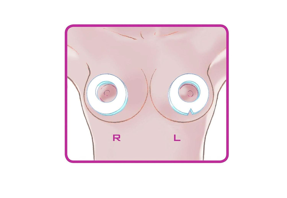 ELANEE Brust-Ringe, Schutz Der Brustwarze Bh-Kontakt Durch Hohllagerung, Ideal Bei Wunden, Entzündeten Brustwarzen Durch Stillen, 10 Stück (222-00) Accessories Food and Breastfeeding Bebe Naty Shop