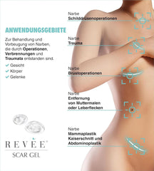 Revée Scar Gel, Topical gel for scars Naty Shop