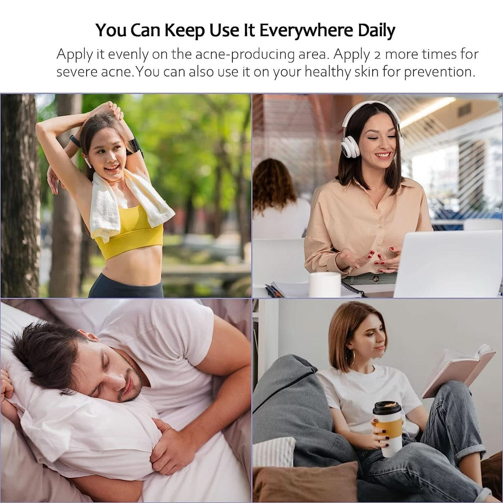 Anti-acne cream, 100 ml Cosmetics and Beauty Naty Shop