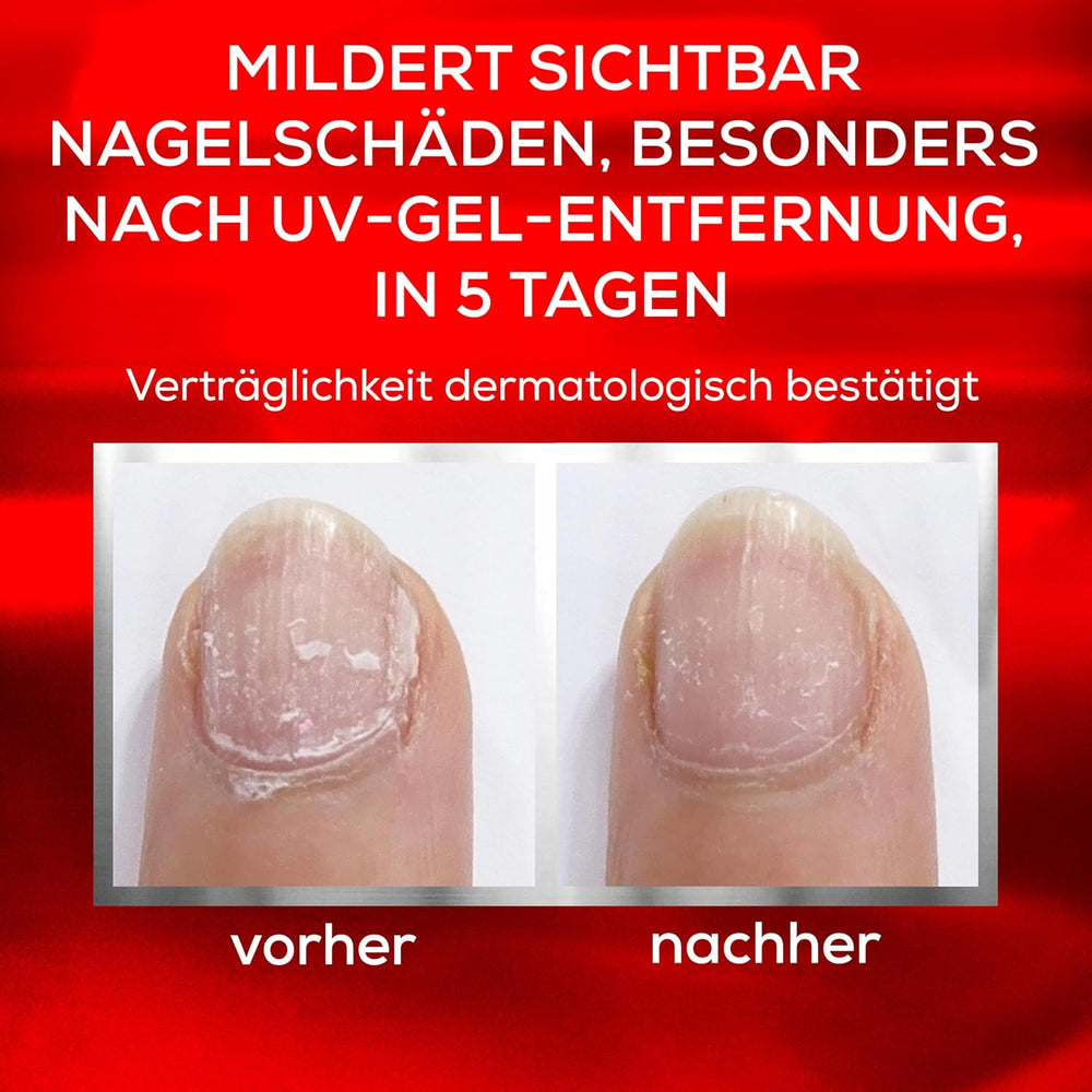 Essie Nail Rescue Kit: Apricot Scented Nail & Cuticle Oil + To the Rescue Repair Nail Polish