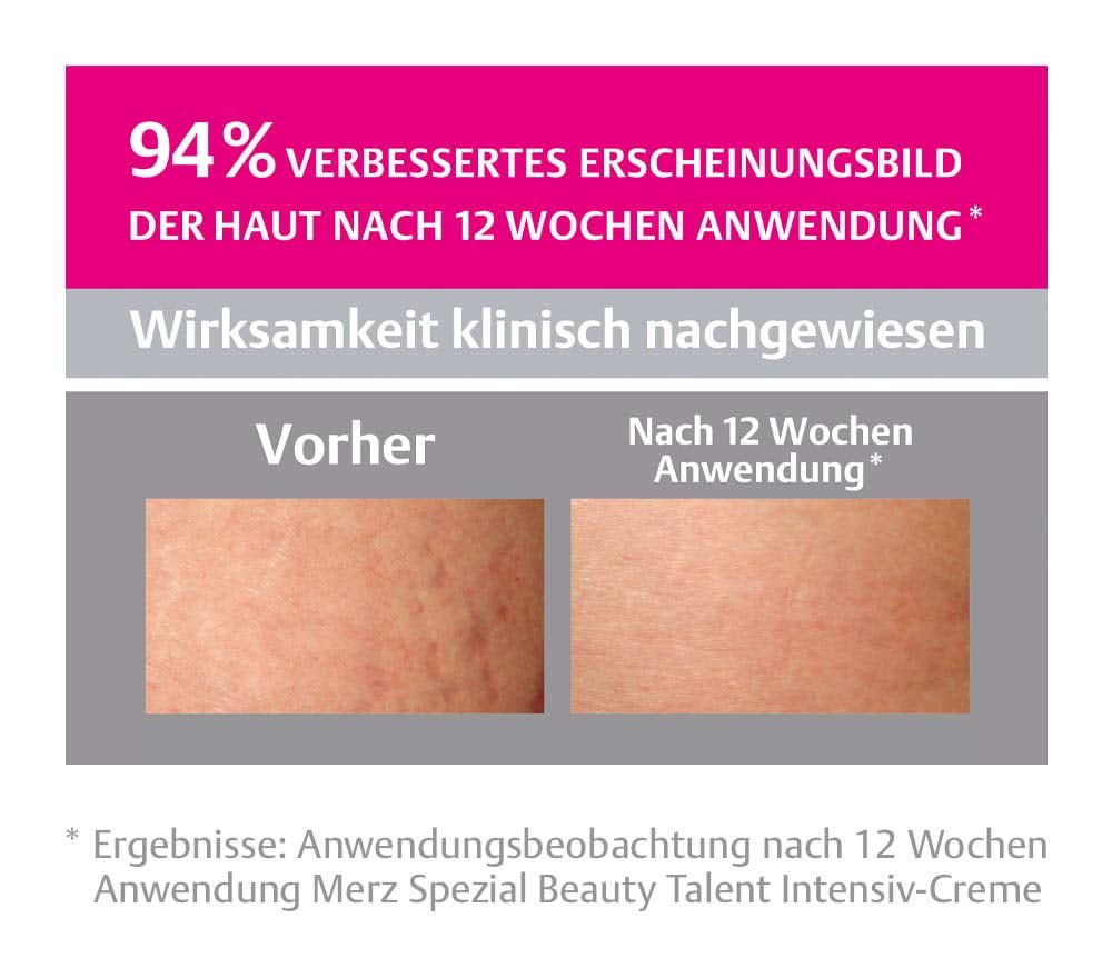 Merz Spezial, Intensive cream for stretch marks, 75 ml Cosmetics and Beauty Naty Shop