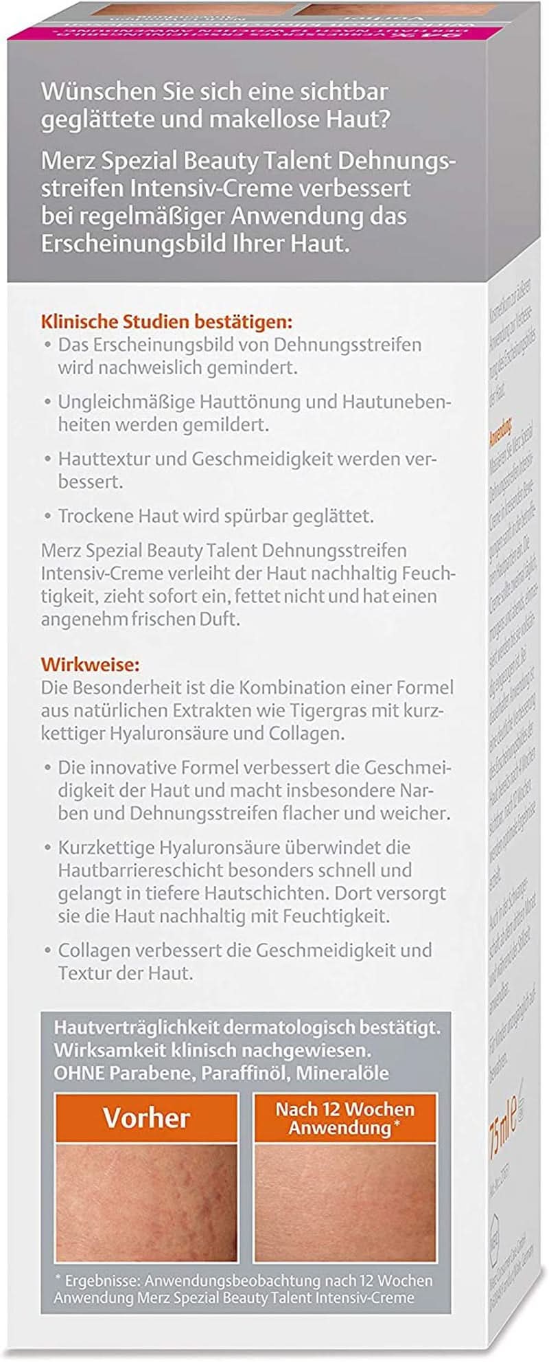 Merz Spezial, Intensive cream for stretch marks, 75 ml Cosmetics and Beauty Naty Shop