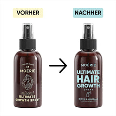 MOÉRIE Ultimate Mineral Hair Growth Spray pentru păr mai lung, mai gros și mai plin - cu biotină și cafeină - produse vegane pentru păr, fără parabeni, toate tipurile de păr, inversează căderea părului - aprovizionare pe 2 luni Ingrijirea parului Naty Shop